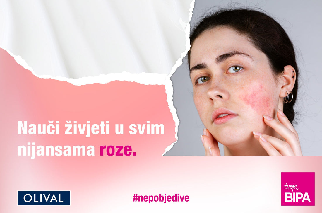 Pridruži nam se u Olival x BIPA savjetovalištu za rozaceju